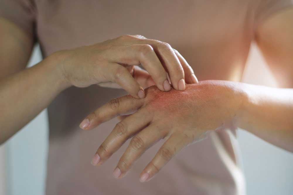 fungal infection treatment