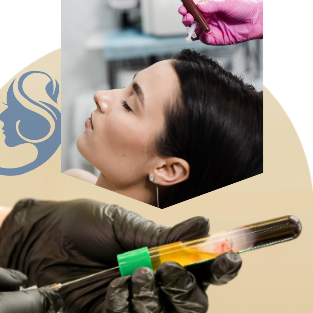 Hair PRP Therapy